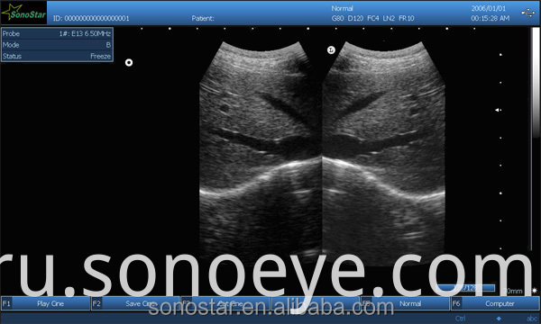 image for labtop ultrasound